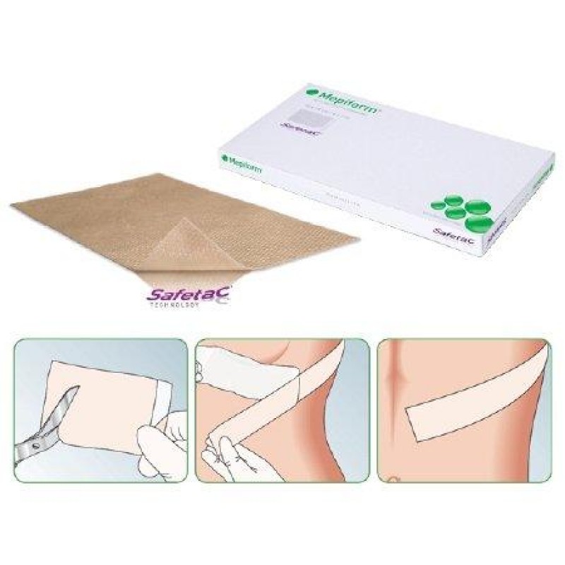 Mepiform® (Мепіформ) 5 х 7,5 см для лікування рубців та шрамів
